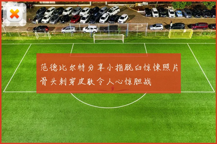 范德比尔特分享小指脱臼惊悚照片骨头刺穿皮肤令人心惊胆战